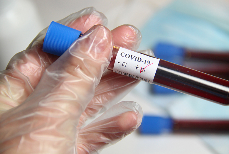 Blodprovsbehållare för covid-19